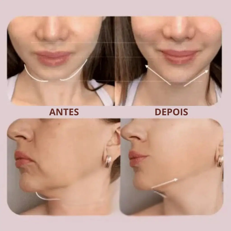 SkinLift Pro – Máscara de Contorno Facial com Efeito Lifting e Redução de Papada